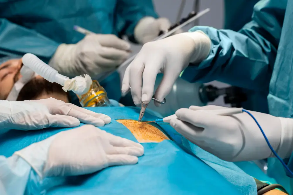 BARIATRIC REVISION SURGERY